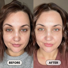 Dermatologist Approved Plumping Cream – Needle-Free Volume in 14 Days