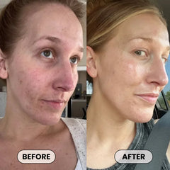 Dermatologist Approved Plumping Cream – Needle-Free Volume in 14 Days