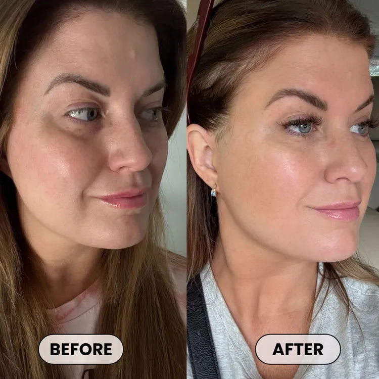 Dermatologist Approved Plumping Cream – Needle-Free Volume in 14 Days