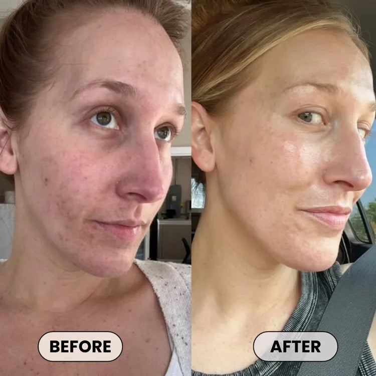 Dermatologist Approved Plumping Cream – Needle-Free Volume in 14 Days