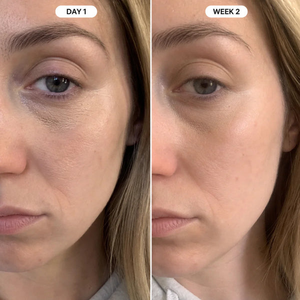 Monica S., 35